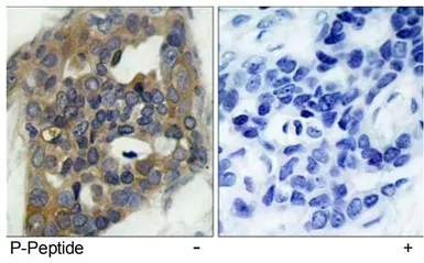 Anti-ASK1 (phospho Ser966) antibody used in IHC (Paraffin sections) (IHC-P). GTX79137