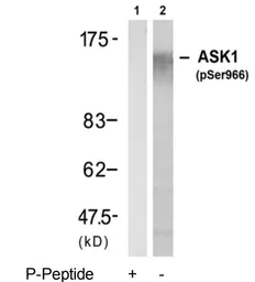 Anti-ASK1 (phospho Ser966) antibody used in Western Blot (WB). GTX79137