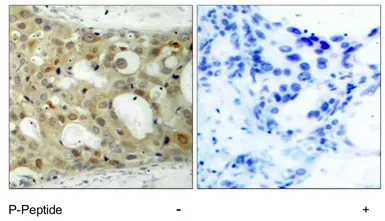 Anti-Androgen Receptor (phospho Ser650) antibody used in IHC (Paraffin sections) (IHC-P). GTX79139
