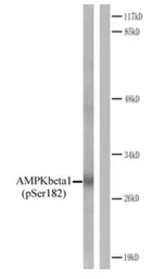 Anti-AMPK beta 1 (phospho Ser182) antibody used in Western Blot (WB). GTX79141