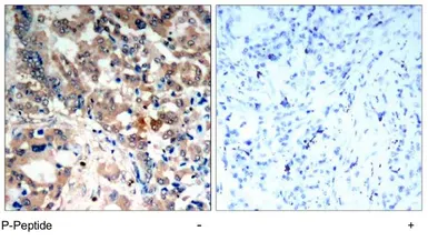 Anti-AMPK alpha 1 (phospho Thr174) antibody used in IHC (Paraffin sections) (IHC-P). GTX79143