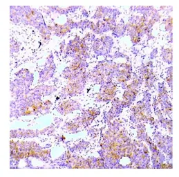 Anti-ALK (phospho Tyr1586) antibody used in IHC (Paraffin sections) (IHC-P). GTX79146