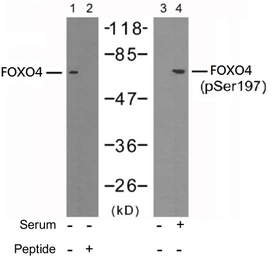 Anti-FOXO4 (phospho Ser197) antibody used in Western Blot (WB). GTX79151