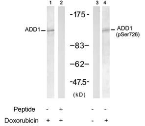 Anti-alpha Adducin (phospho Ser726) antibody used in Western Blot (WB). GTX79152