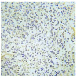Anti-c-Abl (phospho Tyr204) antibody used in IHC (Paraffin sections) (IHC-P). GTX79154