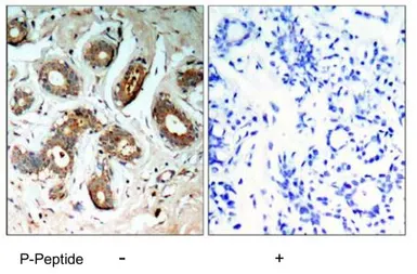 Anti-14-3-3 zeta (phospho Ser58) antibody used in IHC (Paraffin sections) (IHC-P). GTX79155
