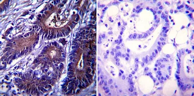 Anti-Heat Shock Protein 104 antibody [Antiserum 8-1] used in IHC (Paraffin sections) (IHC-P). GTX79159