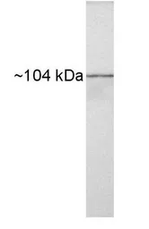 Anti-Heat Shock Protein 104 antibody used in Western Blot (WB). GTX79161