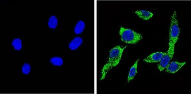 Anti-Cytochrome P450 2C11 antibody used in Immunocytochemistry/ Immunofluorescence (ICC/IF). GTX79174