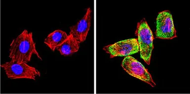 Anti-Cytochrome P450 2C11 antibody used in Immunocytochemistry/ Immunofluorescence (ICC/IF). GTX79174
