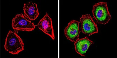 Anti-Cytochrome P450 2C11 antibody used in Immunocytochemistry/ Immunofluorescence (ICC/IF). GTX79174