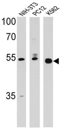 Anti-PPAR delta antibody used in Western Blot (WB). GTX79186