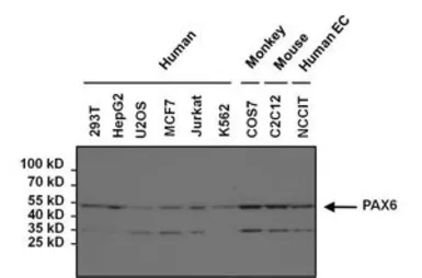 Anti-PAX6 antibody used in Western Blot (WB). GTX79189