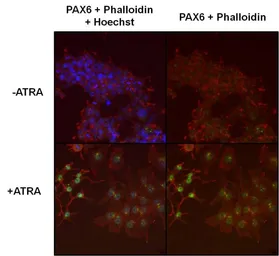 Anti-PAX6 antibody used in Immunocytochemistry/ Immunofluorescence (ICC/IF). GTX79189