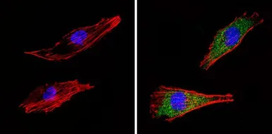 Anti-SEC23A antibody used in Immunocytochemistry/ Immunofluorescence (ICC/IF). GTX79203
