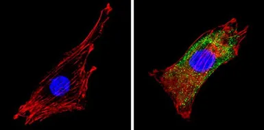 Anti-SEC23A antibody used in Immunocytochemistry/ Immunofluorescence (ICC/IF). GTX79203