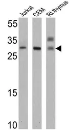Anti-TCR V alpha 12.1 antibody [6D6.6] used in Western Blot (WB). GTX79230