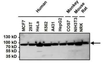 Anti-Hsp90 beta antibody used in Western Blot (WB). GTX79247