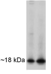 Anti-APH1A antibody used in Western Blot (WB). GTX79306
