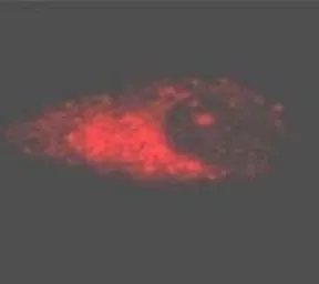Anti-APH1A antibody used in Immunocytochemistry/ Immunofluorescence (ICC/IF). GTX79306