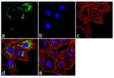 Anti-APH1A antibody used in Immunocytochemistry/ Immunofluorescence (ICC/IF). GTX79306