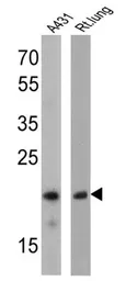 Anti-Caveolin 1 antibody [7C8] used in Western Blot (WB). GTX79350