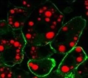 Anti-Caveolin 1 antibody [7C8] used in Immunocytochemistry/ Immunofluorescence (ICC/IF). GTX79350