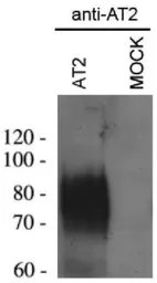 Anti-AGTR2 antibody used in Western Blot (WB). GTX79393