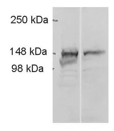 Anti-ADAMTS9 antibody used in Western Blot (WB). GTX79416