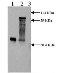 Anti-uPA antibody [H77A10] used in Western Blot (WB). GTX79572