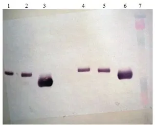 Anti-Renin antibody [7D3-E3] used in Western Blot (WB). GTX79644
