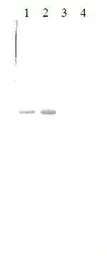 Anti-Prothrombin antibody [9013] used in Western Blot (WB). GTX79651