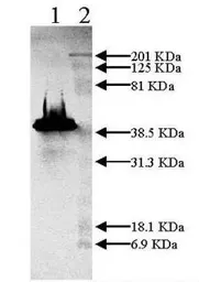 Anti-PAI-1 antibody used in Western Blot (WB). GTX79737