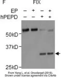 Anti-Factor IX antibody [5041] used in Western Blot (WB). GTX79802