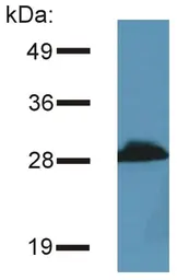 Anti-PRR7 antibody [TRAP3/10] used in Western Blot (WB). GTX79873