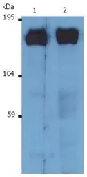 Anti-SOS1 antibody [SOS-01] used in Western Blot (WB). GTX79891