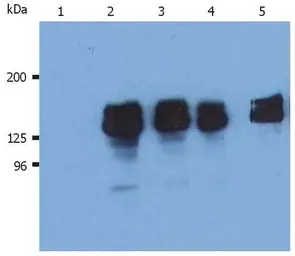 Anti-SHIP1 antibody [SHIP-01] used in Western Blot (WB). GTX79894