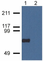 Anti-CPNE7 antibody [CPNE7-01] used in Western Blot (WB). GTX80188