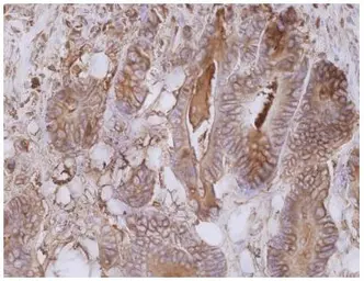 Anti-CD66e antibody [CB30] used in IHC (Paraffin sections) (IHC-P). GTX80201