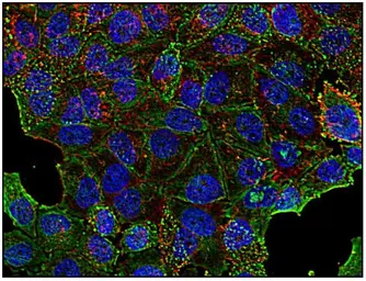 Anti-Clathrin Heavy chain antibody [BF-06] used in Immunocytochemistry/ Immunofluorescence (ICC/IF). GTX80218