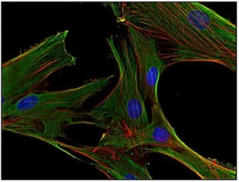 Anti-Clathrin Heavy chain antibody [BF-06] used in Immunocytochemistry/ Immunofluorescence (ICC/IF). GTX80218