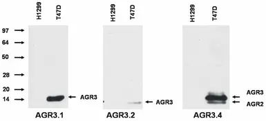 Anti-AGR2+AGR3 antibody [AGR3.4] used in Western Blot (WB). GTX80239