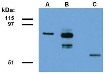 Anti-CCDC98 antibody [ABRA1-01] used in Western Blot (WB). GTX80242