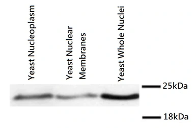 Anti-Mad2 antibody used in Western Blot (WB). GTX80373