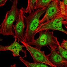 Anti-CARM1 antibody [3H2] used in Immunocytochemistry/ Immunofluorescence (ICC/IF). GTX80395