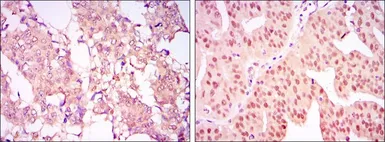 Anti-CARM1 antibody [3H2] used in IHC (Paraffin sections) (IHC-P). GTX80395