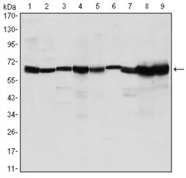 Anti-CARM1 antibody [3H2] used in Western Blot (WB). GTX80395