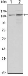Anti-KDM3A antibody [1E12] used in Western Blot (WB). GTX80407