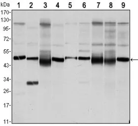 Anti-FOXD3 antibody [5G9] used in Western Blot (WB). GTX80414