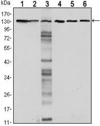 Anti-E-Cadherin antibody [7A2] used in Western Blot (WB). GTX80415